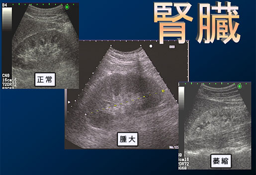腎臓