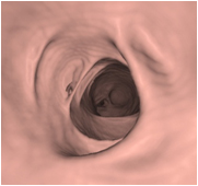 大腸ＣＴ画像（正常部位）