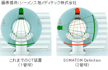 こちらの画像をクリックすると、CTスキャンイメージが再生されます