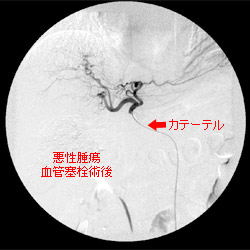 治療後
