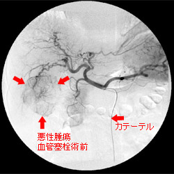治療前