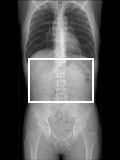 ３次元腹部血管画像