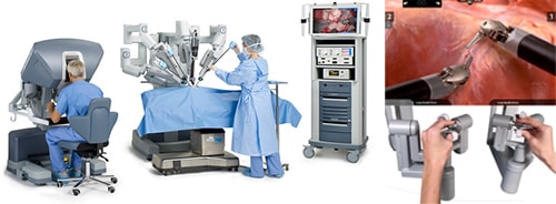 手術支援ロボットの特徴