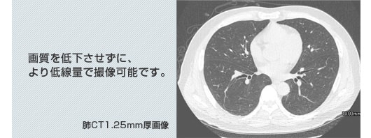 肺CT1.25mm厚画像 画質を低下させずに、より低線量で撮像可能です。
