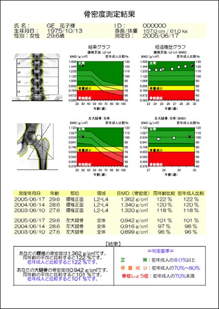 骨密度測定結果