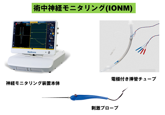 神経モニタリング装置